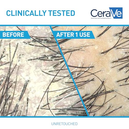 CeraVe Hydrating Anti Dandruff Shampoo, 1% Pyrithione Zinc Dandruff Treatment With Ceramides, Niacinamide & Hyaluronic Acid, Helps Eliminate Flakes & Provides Itchy Scalp Relief, Sulfate Free, 19 Oz