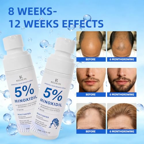 KELUAL DS 5% Minoxidil Spray for Hair Growth with Biotin & Rosemary - 120ML