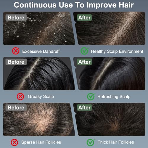 Red Light Therapy Hair Growth Comb with Laser