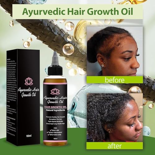 LIFEWITQUEENP Ayurvedic Hair Growth Oil - Lightweight Herbal Scalp Oil for All Hair Types, 1 Bottle