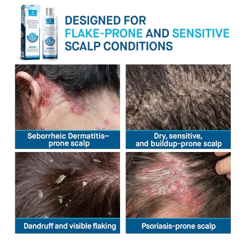 RoyceDerm Seborrheic Dermatitis Shampoo with Salicylic Acid