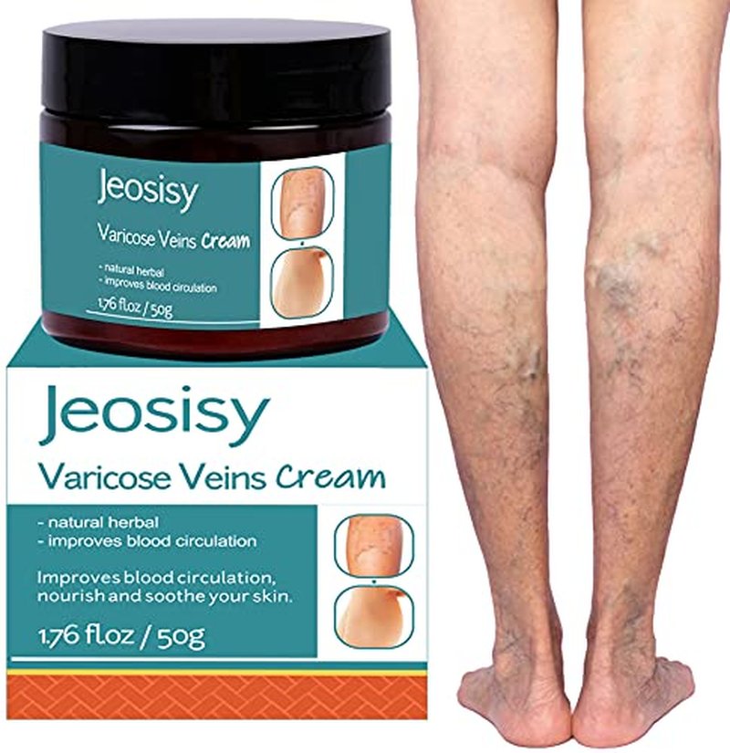 Natural Varicose Vein Cream for Soothing Legs & Skin