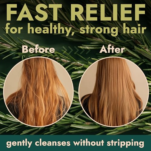 Rosemary Tea Tree Shampoo & Conditioner Set - Scalp Relief & Hair Growth