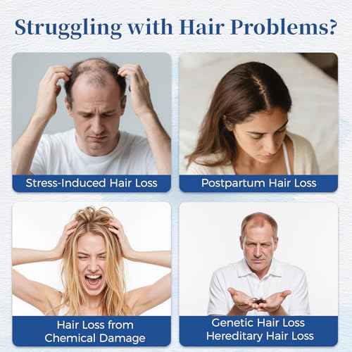 Hair Growth Serum Roll On 25ml with Saw Palmetto, Rosemary & Pea Extract£¬Helps Support Thicker, Fuller Hair Appearance£¬Clean, Non-Greasy Hair Loss Support for Men & Women Pack of 1