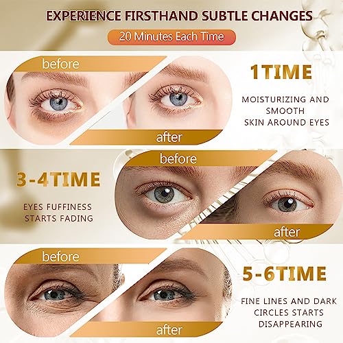 24K Gold Eye Masks 60Pc - Hydrating Collagen Under Eye Patches