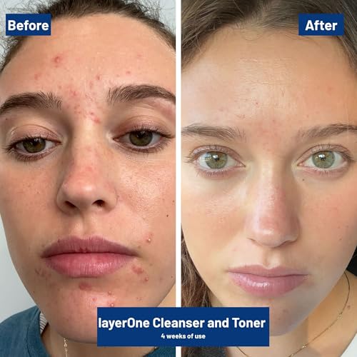 layerOne Clarifying Enzyme Cleanser, Gentle Daily Facial Exfoliant, Pore-Cleansing Formula, 3.38 fl oz