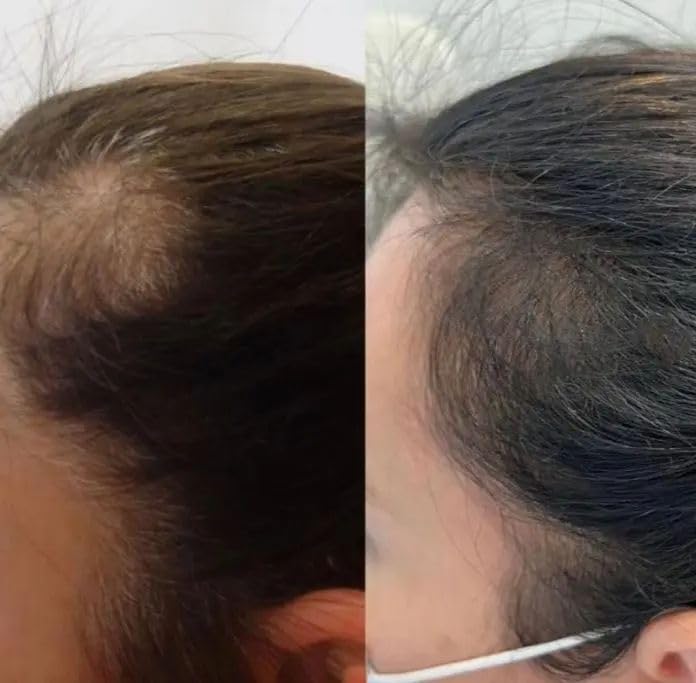 Biotin Hair Growth Shampoo with Collagen | Sulfate-Free Cleanser for Thinning Hair, Mango & Shea Butter 8 oz