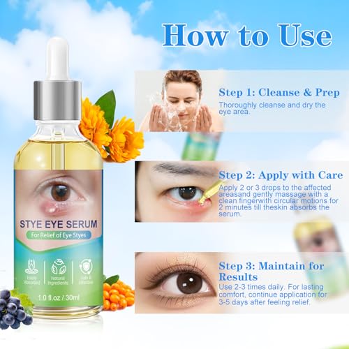 Stye Eye Relief Serum & Eyelid Drops for Blepharitis, Chalazion Styes Redness | Under Eye Serum Natural, Stye Drops for Infected Eyes Fast-Acting | Gentle Care 30ml