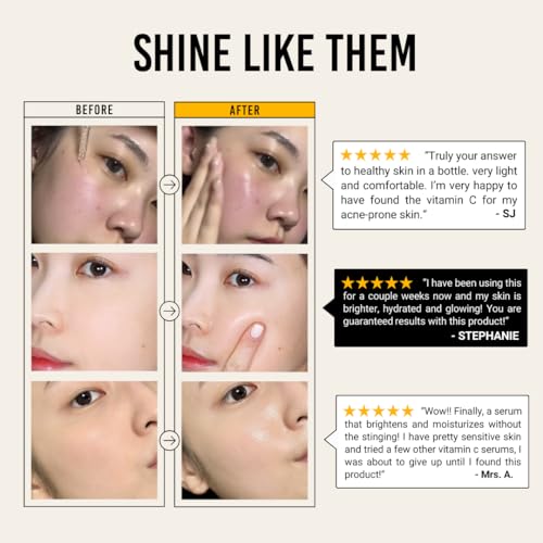 JUMISO All Day Vitamin Serum, Brightening & Balancing Facial Serum, Gift, Vitamin C, A, B, D, E , Serum with Vitamin, Korean Skincare, Skin brightening, soothing, Vegan serum, Vitamin tree extract 86.14%, Niacinamide 20,000ppm,1.01 fl oz (serum)