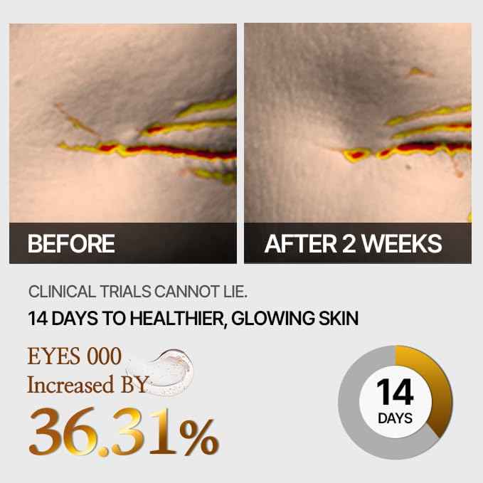 Wrinkle Argireline Serum – GLASS SKIN 14 Days Miracle Cellinto TOX 5D Shot – Korean Anti-Aging Serum with Matrixyl 3000, Collagen & Hyaluronic Acid – Smooths Fine Lines & Firms Skin – 0.47 oz