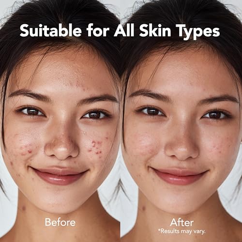 Saplaya K-Beauty Blemish Patches (24 Count) – Ultra-Thin Spot Treatment