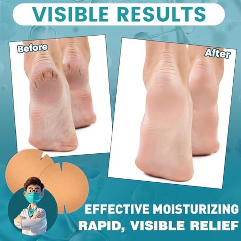 TEAWOO Cracked Heel Treatment Patches - 30 Pack Repair Bandages