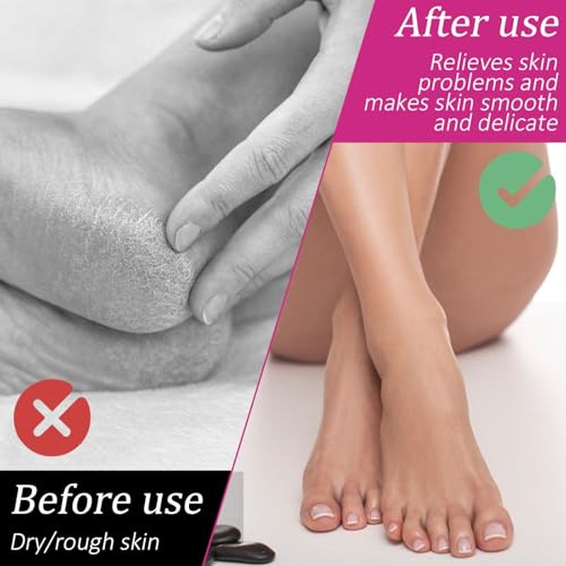 3 Pairs Moisturizing Socks for Overnight Foot Care