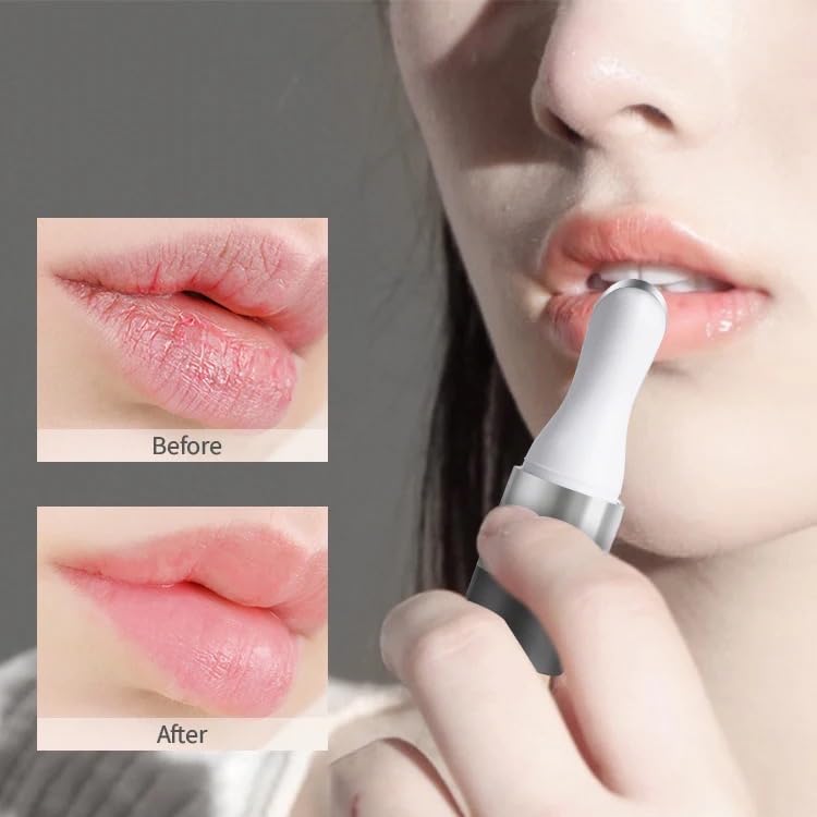 Top Bella Electric Lip Plumper with Vibration Massage