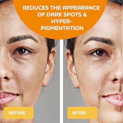 Vitamin C Serum with Hyaluronic Acid, Niacinamide & Natural Extracts ? Hydrating & Brightening Face Serum ? Helps reduce the Look of Dark Spots, Dullness & Pores ? For All Skin Types