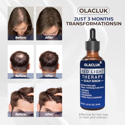 Red Light Therapy Scalp Serum with Copper Peptides | Hair Growth
