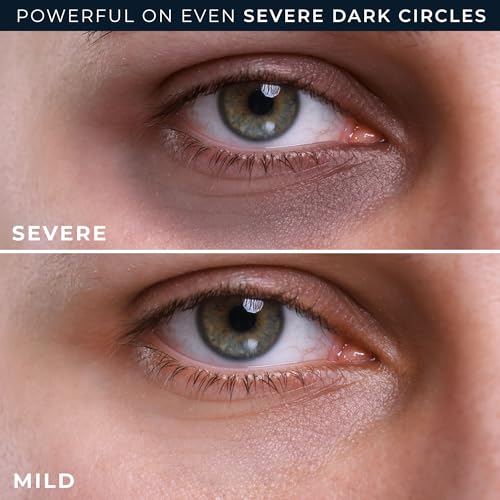 RoC Derm Correxion Retinol Eye Cream - Dark Circles & Wrinkles