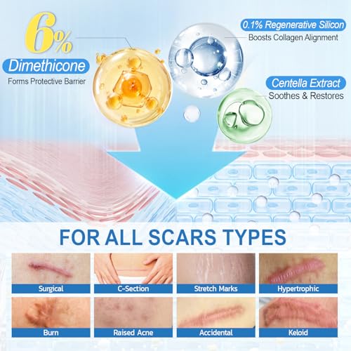 Scar Cream 6% Dimethicone Silicone Cream for Scars, Advanced Scar Removal Cream for Surgical, C-Section, Acne, Keloids, Burns, Old & New Scars, with Scar Tape, 1.69 fl.oz + 1.5m