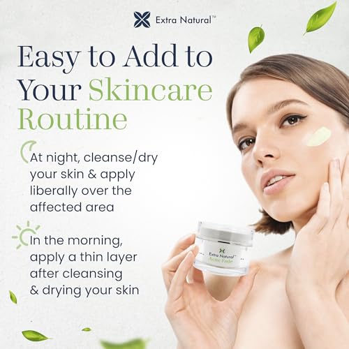 ExtraNatural Acne Cream ? Natural & Gentle Acne Treatment for Sensitive & Oily Skin ? Helps Reduce Breakouts, Pimples & Redness