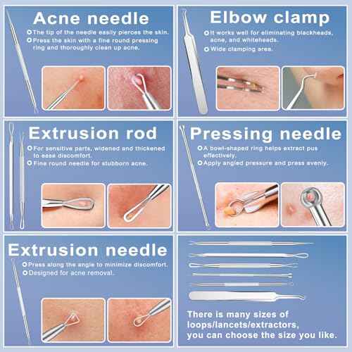 Pimple Extractor Tools, 6-PCS Professional Stainless Steel Blackheads, Whiteheads, Pimples, Boils, Stray Hairs Remover Tools Set with Mirror and Product User Manual, 18-Month Replacement Warranty£¡