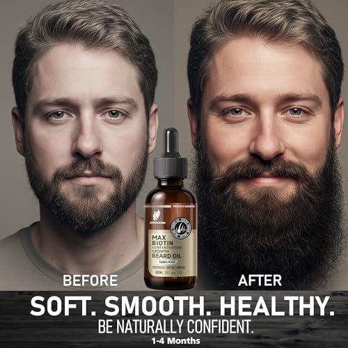 Biotin Beard Growth Oil for Men - Vitamin B5 & Castor Oil Formula, Nourish & Thicken Facial Hair, Daily Beard Care, Styling & Taming, Hydrating, Non-Greasy, Sandalwood 2oz Gift for Him