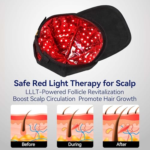 Wireless Red Light Therapy Cap for Hair Growth - FDA Cleared