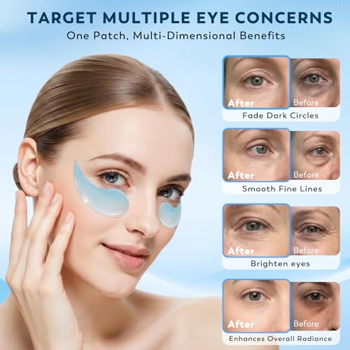 Retinol Collagen Under Eye Patches 30 Pairs | Hydrogel Eye Masks