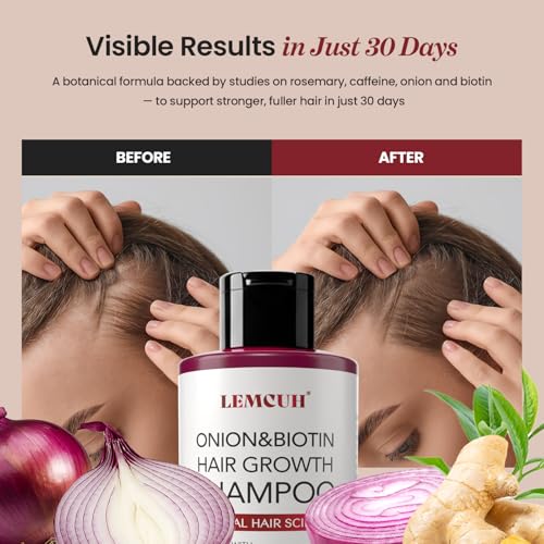 Onion Hair Growth Shampoo for Thicker Hair - 12.5 fl oz