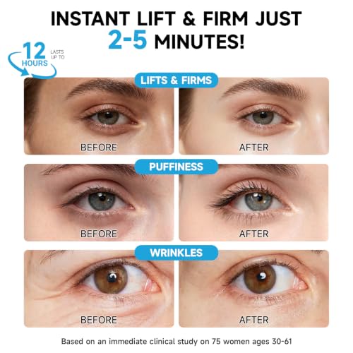 Instant Eye Lift & Retinol Cream for Bags, Wrinkles & Puffiness
