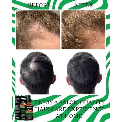 Batana Oil for Hair Growth, with Rosemary Oil Maca Argan Jojoba Oil, Promotes Hair Thickness, Nourish Scalp and Hair for All Hair Tapes | Glass Bottle with Dropper | 1fl oz + 1 fl oz