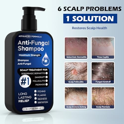 Antifungal Shampoo for Seborrheic Dermatitis & Dandruff