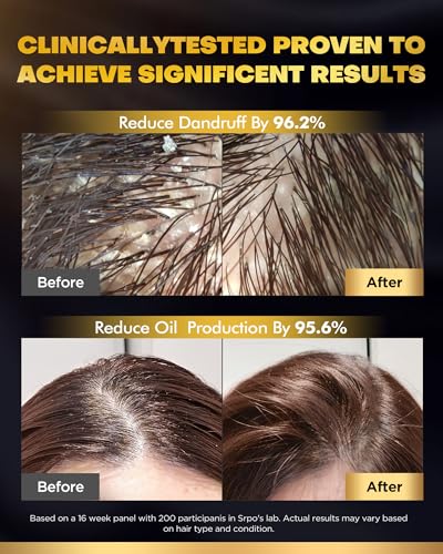 Biotin Hair Growth Shampoo and Conditioner Set - 2x16.9oz