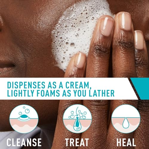 CeraVe Acne Foaming Cream Cleanser 4% Benzoyl Peroxide