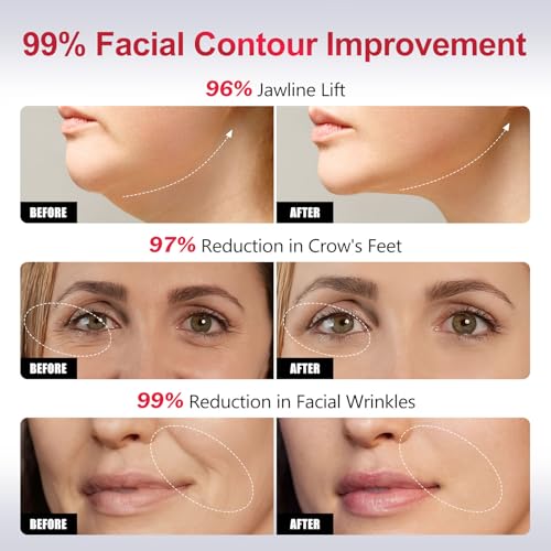 2-in-1 Red Light Microcurrent Facial Device | Enhances Lifting & Firming Capabilities | Reduces Wrinkles and Puffiness | Smart Photon Micro-Current Device, Model:EP-300