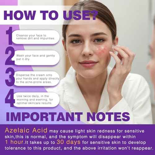 14% Azelaic Acid Acne Cream, Premium Azelaic Acid Facial Cream - Redness Relief For Face, Redness Reducing Skin Care, Prevents Acne Breakouts, Ease Pimple Clarify Skin Soothe Irritation,1 Oz