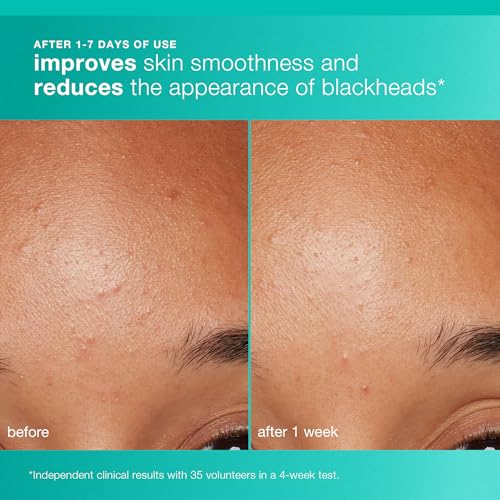 Dermalogica Clear and Brighten Kit, 3 Step Facial Skincare Set - Includes Face Cleanser, Exfoliator, and Serum