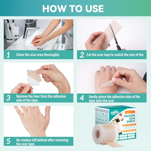 Silicone Scar Tape, Silicone Scar Sheets(1.6"X 160" Roll-4M), Reusable Medical Grade Silicone Tape for Scars, C-Section, Keloid, Acne, Tummy Tuck, Surgical Scars, Light