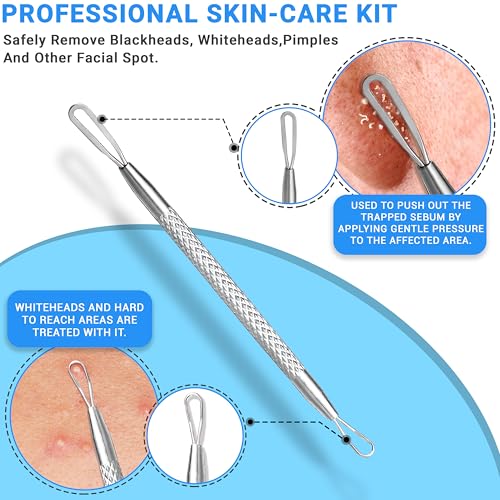 Stainless Steel Pimple Extractor Tool 2-Pc Set Blackhead Remover