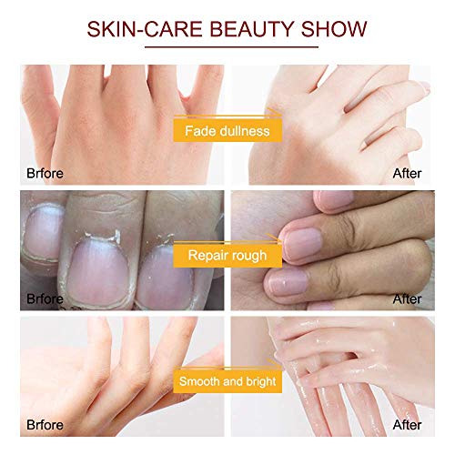 ZIXAOK Moisturizing Hand Mask Gloves for Extra Dry Hands - 5 Pairs Spa Set