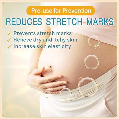 Pregnancy Stretch Mark Oil - Cocoa Butter & Vitamin E, 4.06oz