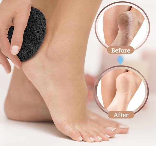 RDRKR Pumice Stone Foot and Hand Scrubber - Natural Lava Stone for Callus Remover, Foot Exfoliation, Hand Scrub, Pedicure Tool, Dry Skin Remover, Promote Healthy Foot and Hand Care (Black)