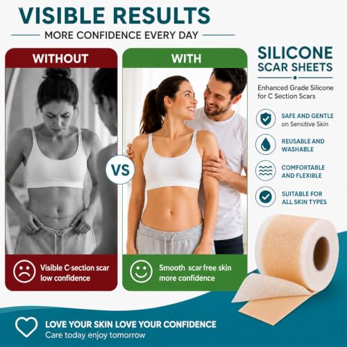 Premium Silicone Scar Sheets for Surgical Scars - 1.57" x 157" Roll