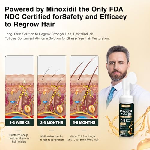 5% Minoxidil Foam for Hair Growth - 3 Pack (6.33oz)