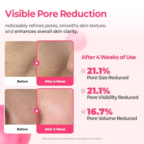 Dr.Melaxin Cyano Pink Spicule Serum | Microneedle Facial Treatment, 1.01 fl.oz