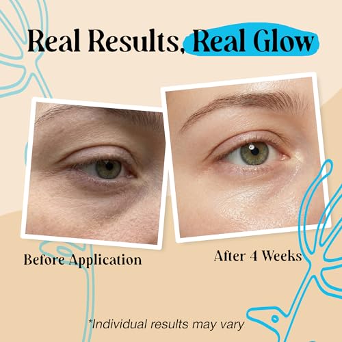LivaClean Retinol Under Eye Balm Stick for Dark Circles & Puffiness, 2 Pack