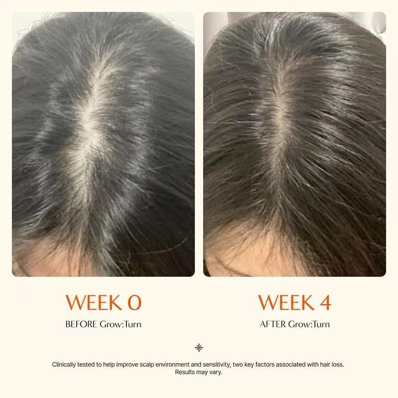 GROWTURN Hair Growth Serum for Thicker, Stronger Hair