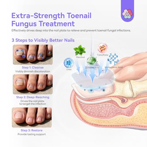 SAVILAND Toenail Fungus Treatment Extra Strength 2 fl oz