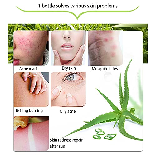 300x2 ML Natural Aloe Vera Gel -Organic Moisturizing Aloe Vera, Soothing and Hydrating, Sunburn and Scar Repair, After Sun Care for Face Body Hair