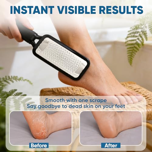 Large Stainless Steel Foot File Callus Remover with Waterproof Pedicure Tool