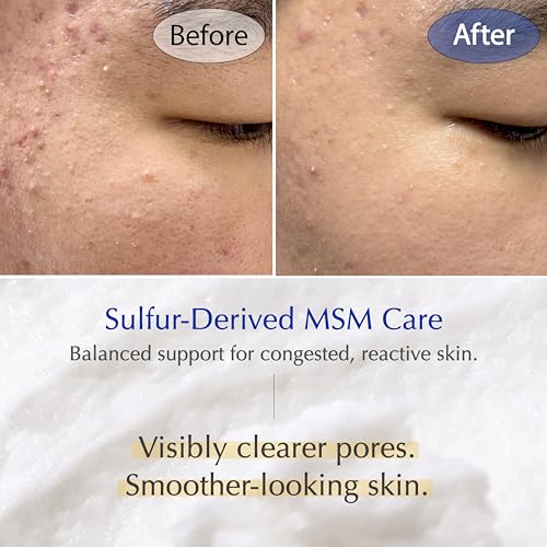 MSM Sulfur Deep Pore Cleanser ? Low pH Barrier-Respecting Face Wash, Pore Reset for Sensitive Skin